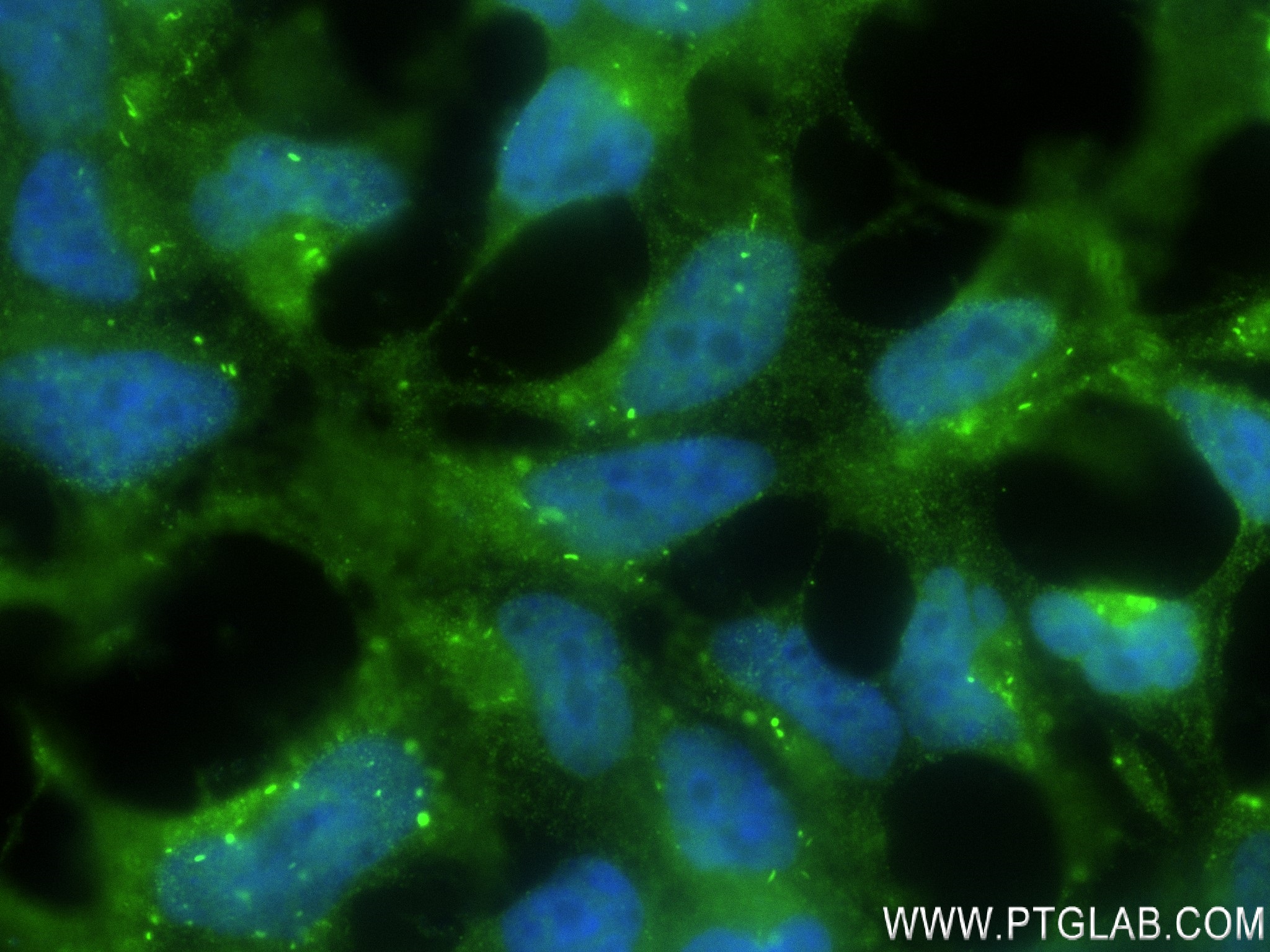 Immunofluorescence (IF) / fluorescent staining of HEK-293T cells using Chk1 Recombinant antibody (80056-2-RR)