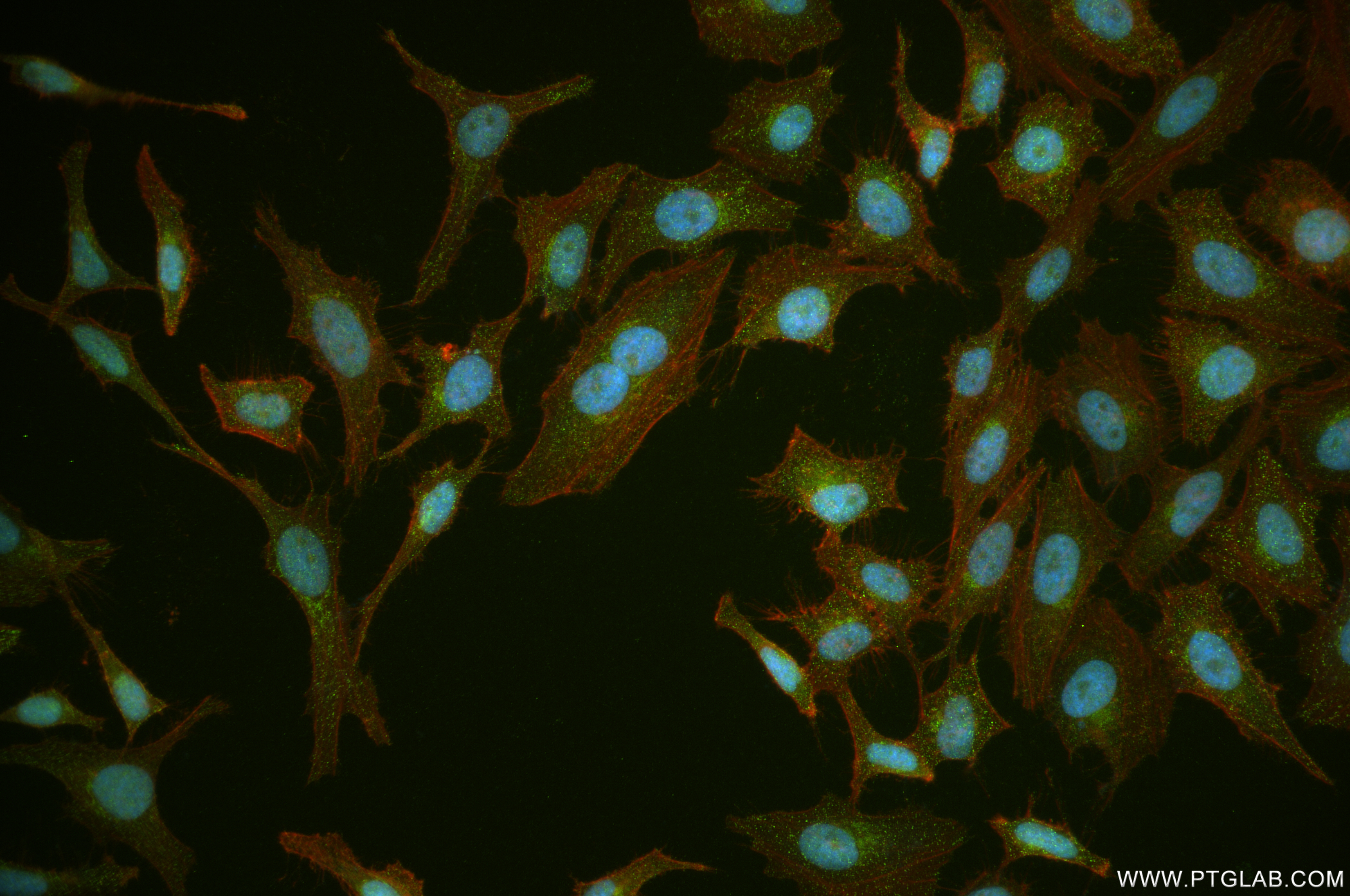 Immunofluorescence (IF) / fluorescent staining of HeLa cells using Chk1 Recombinant antibody (84905-1-RR)