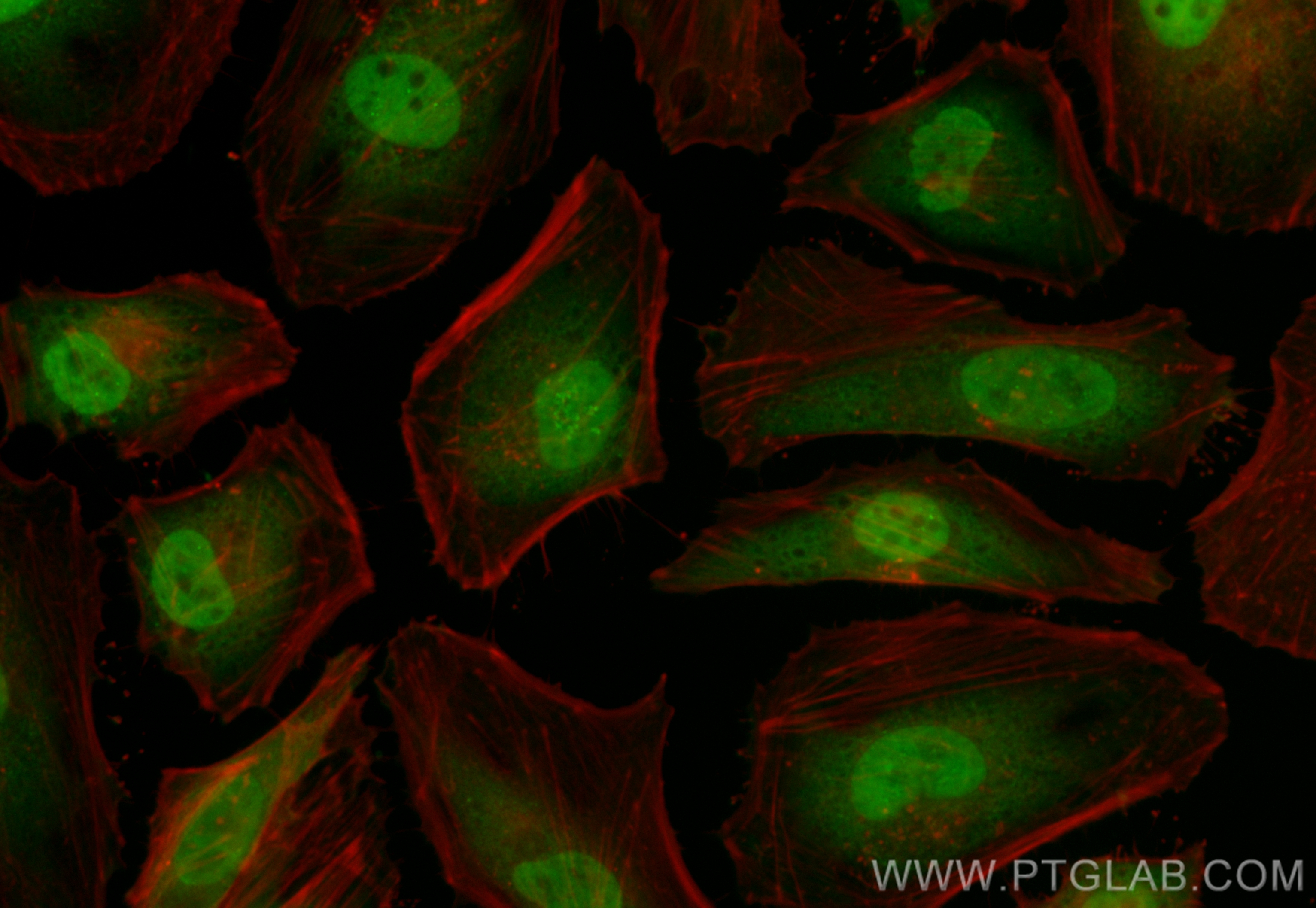 Immunofluorescence (IF) / fluorescent staining of HeLa cells using CoraLite® Plus 488-conjugated Chk1 Recombinant ant (CL488-80056-2)