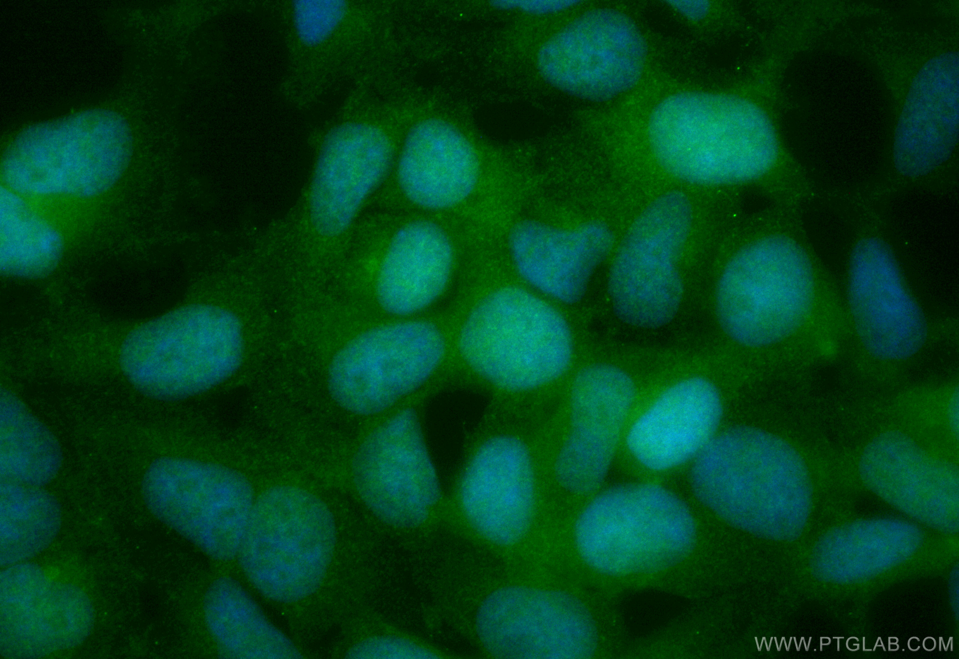 Immunofluorescence (IF) / fluorescent staining of HEK-293 cells using CoraLite® Plus 488-conjugated Chk1 Recombinant ant (CL488-84905)