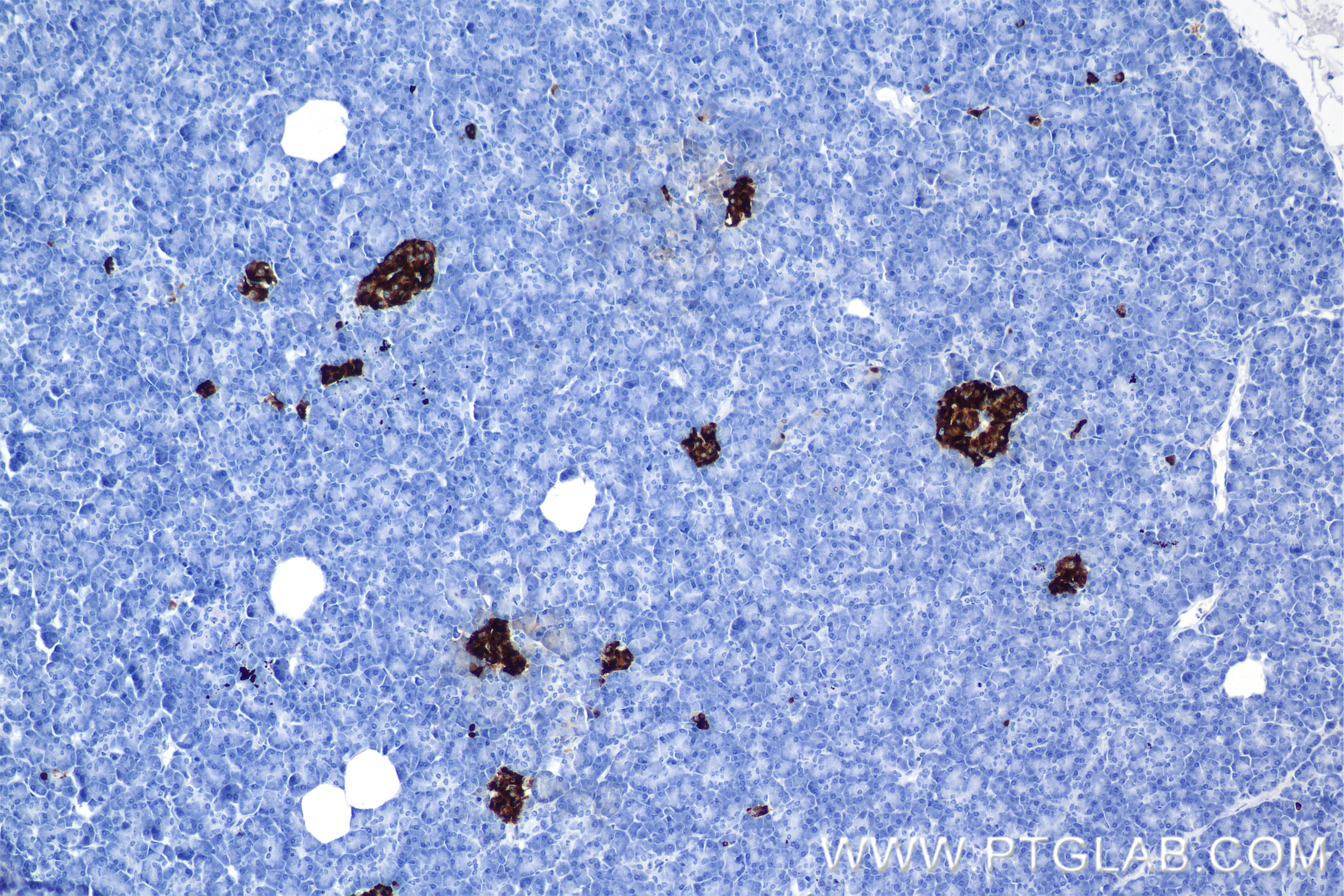 Immunohistochemistry (IHC) staining of human pancreas tissue using Chromogranin A Recombinant antibody (85605-2-RR)