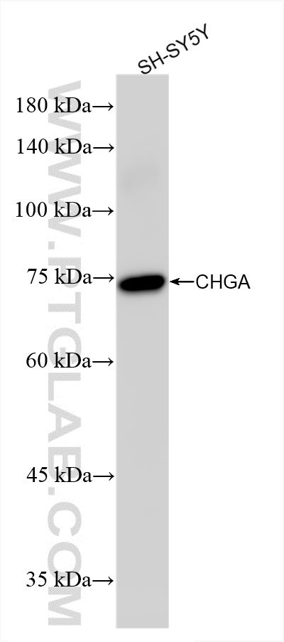 Western Blot (WB) analysis of various lysates using Chromogranin A Recombinant antibody (85605-2-RR)
