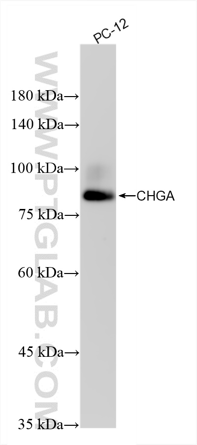 Western Blot (WB) analysis of various lysates using Chromogranin A Recombinant antibody (85605-2-RR)