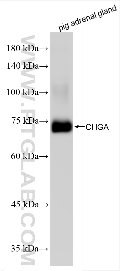 Western Blot (WB) analysis of various lysates using Chromogranin A Recombinant antibody (85605-2-RR)