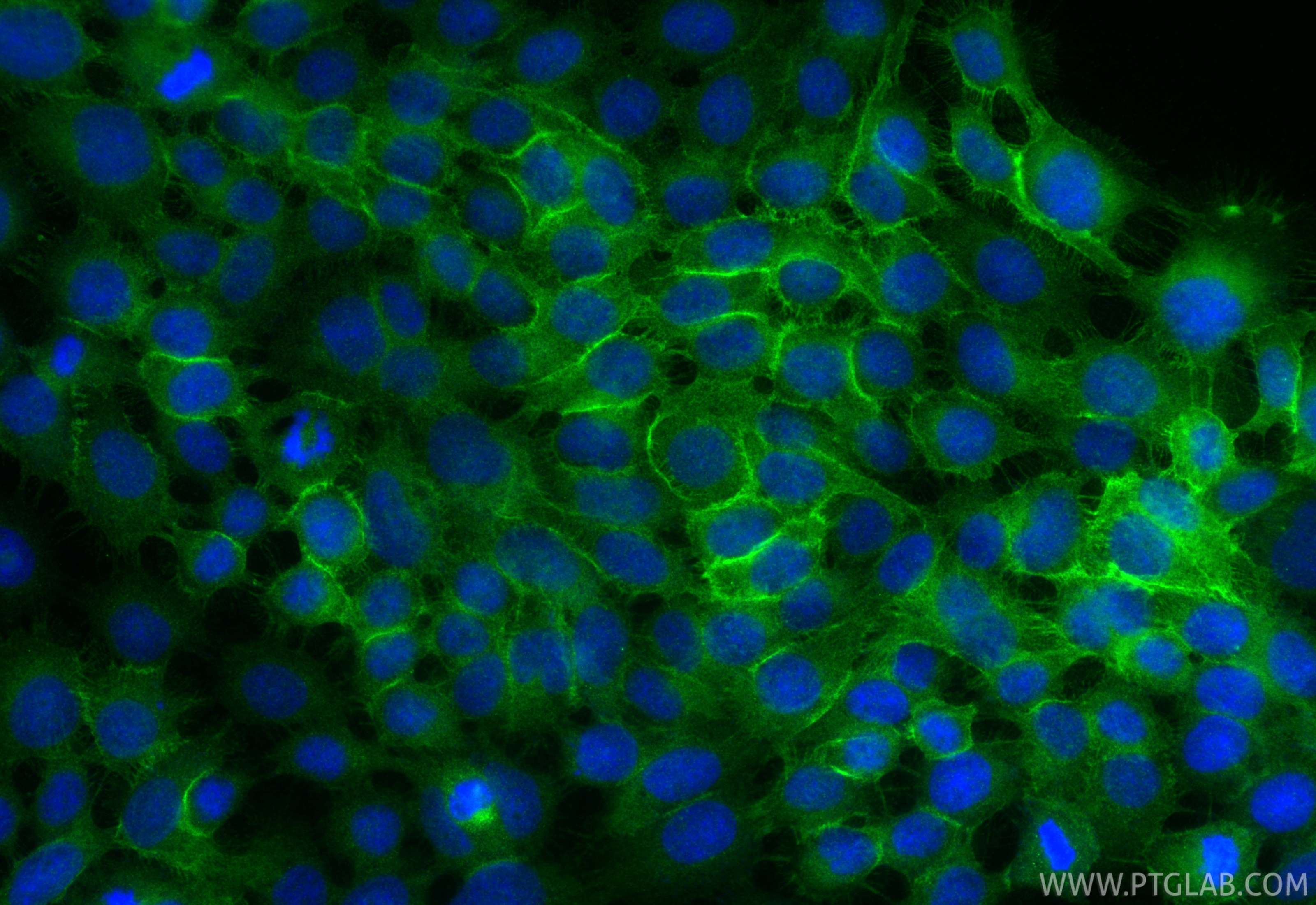 Immunofluorescence (IF) / fluorescent staining of A431 cells using Claudin 1 Polyclonal antibody (28674-1-AP)