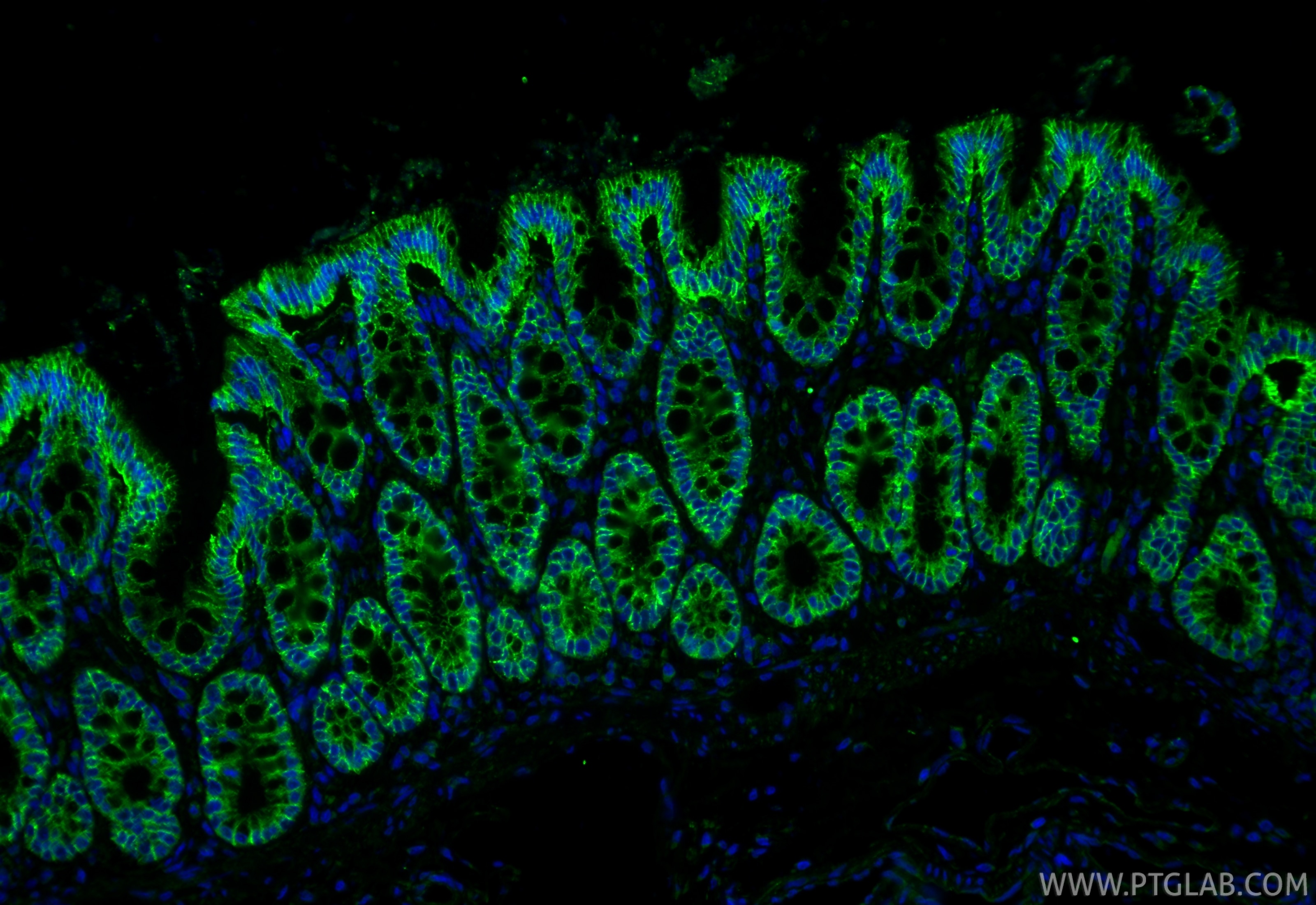 Immunofluorescence (IF) / fluorescent staining of rat colon tissue using Claudin 1 Polyclonal antibody (28674-1-AP)