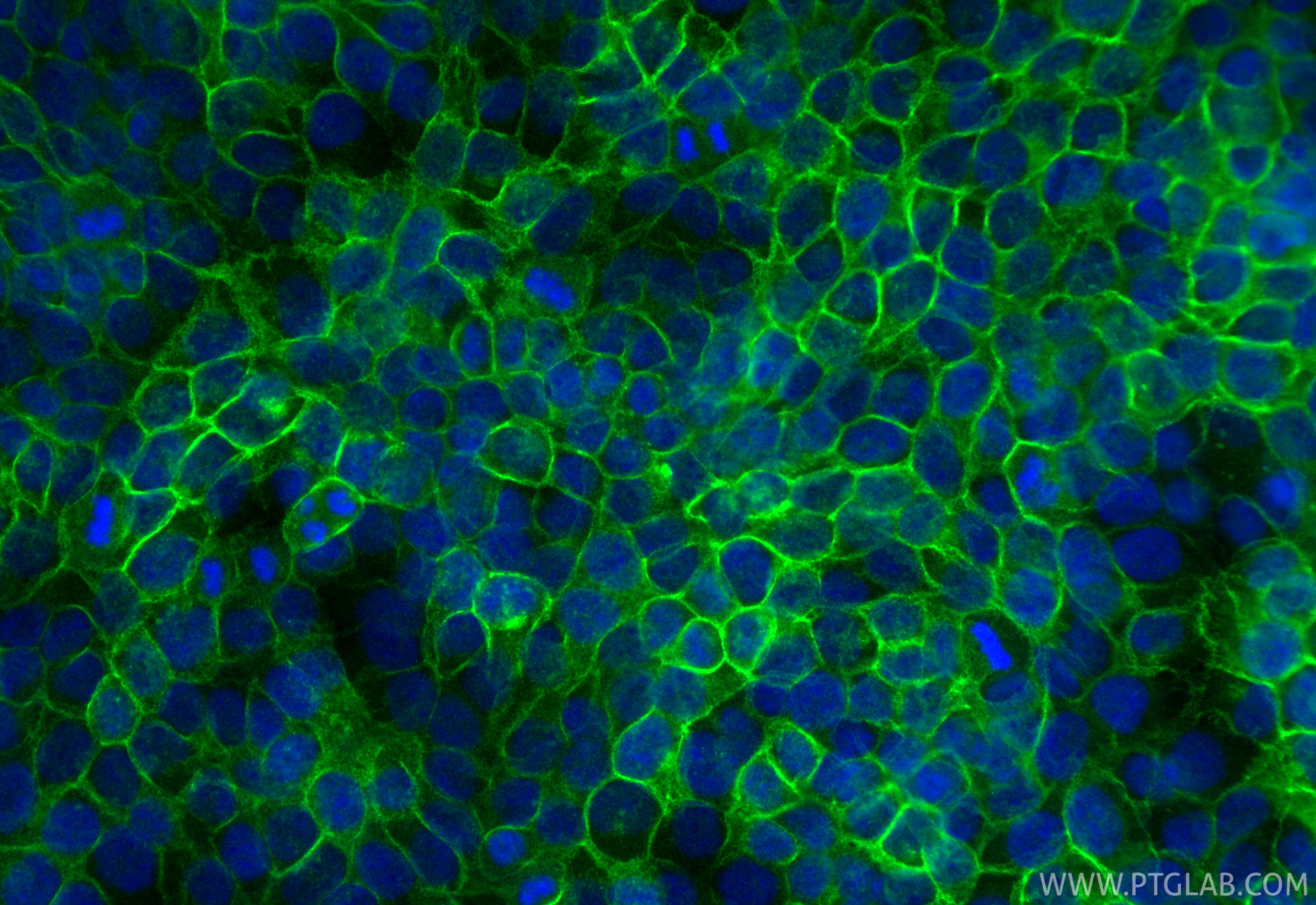 Immunofluorescence (IF) / fluorescent staining of HaCaT cells using Claudin 1 Polyclonal antibody (28674-1-AP)