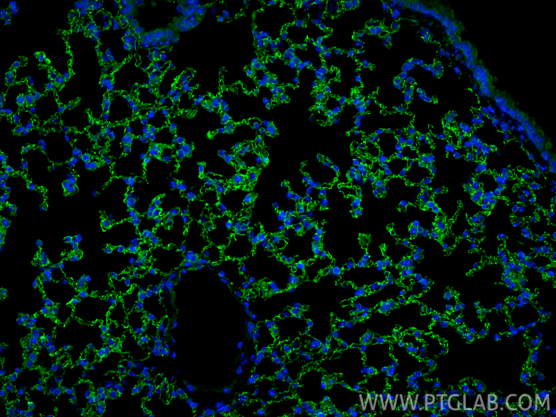 Immunofluorescence (IF) / fluorescent staining of mouse lung tissue using Claudin 5 Polyclonal antibody (29767-1-AP)