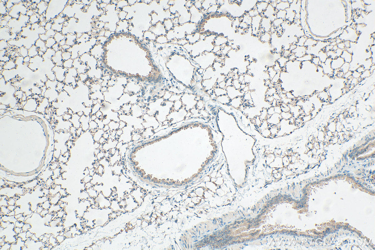 Immunohistochemistry (IHC) staining of mouse lung tissue using Claudin 5 Polyclonal antibody (29767-1-AP)