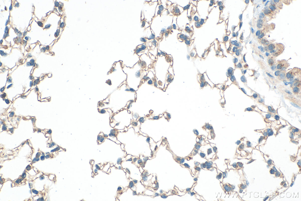 Immunohistochemistry (IHC) staining of mouse lung tissue using Claudin 5 Polyclonal antibody (29767-1-AP)