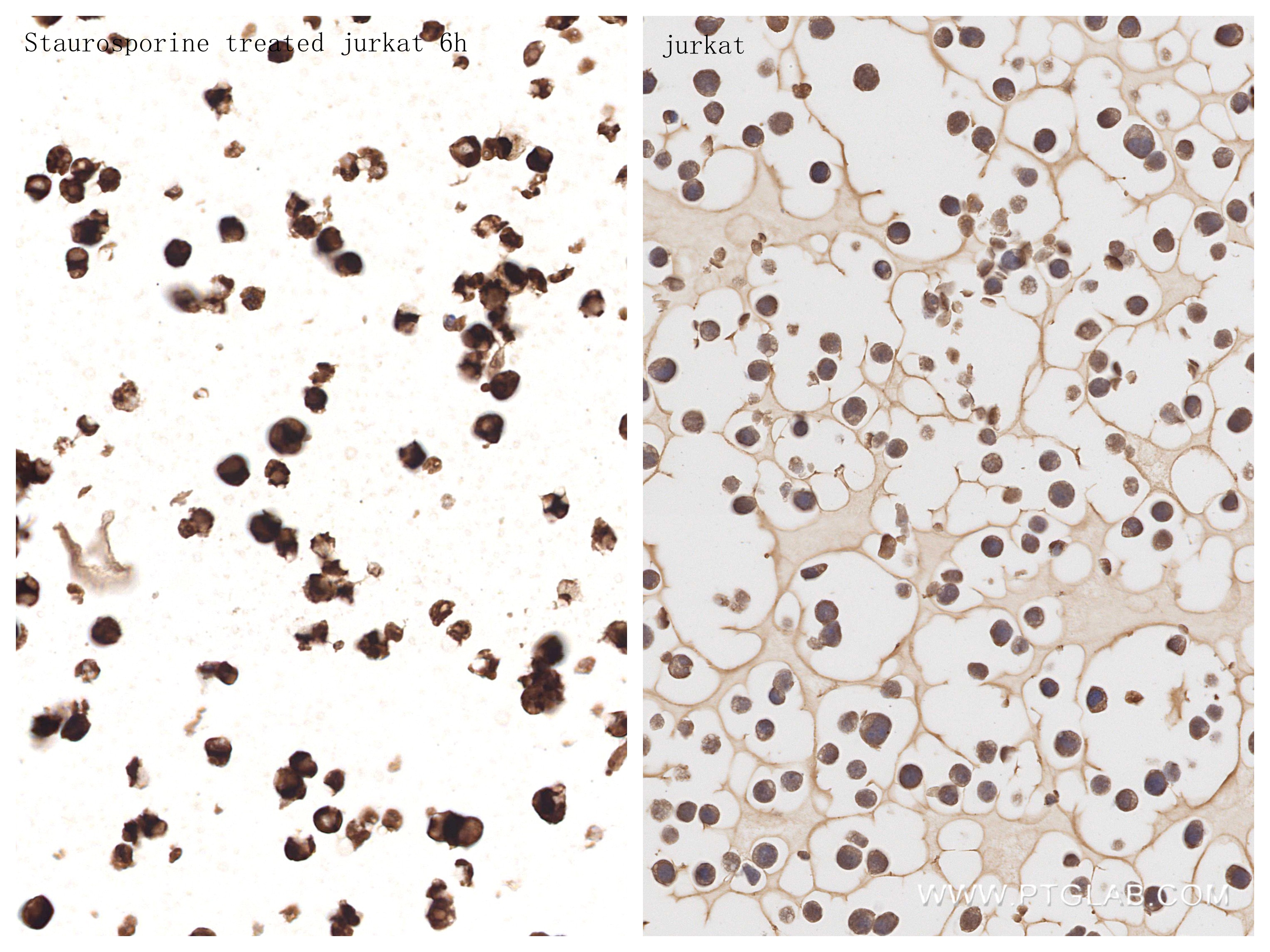 Immunohistochemistry (IHC) staining of Jurkat cells using Cleaved Caspase 3/P17/P19 Recombinant monoclonal a (82707-13-RR)