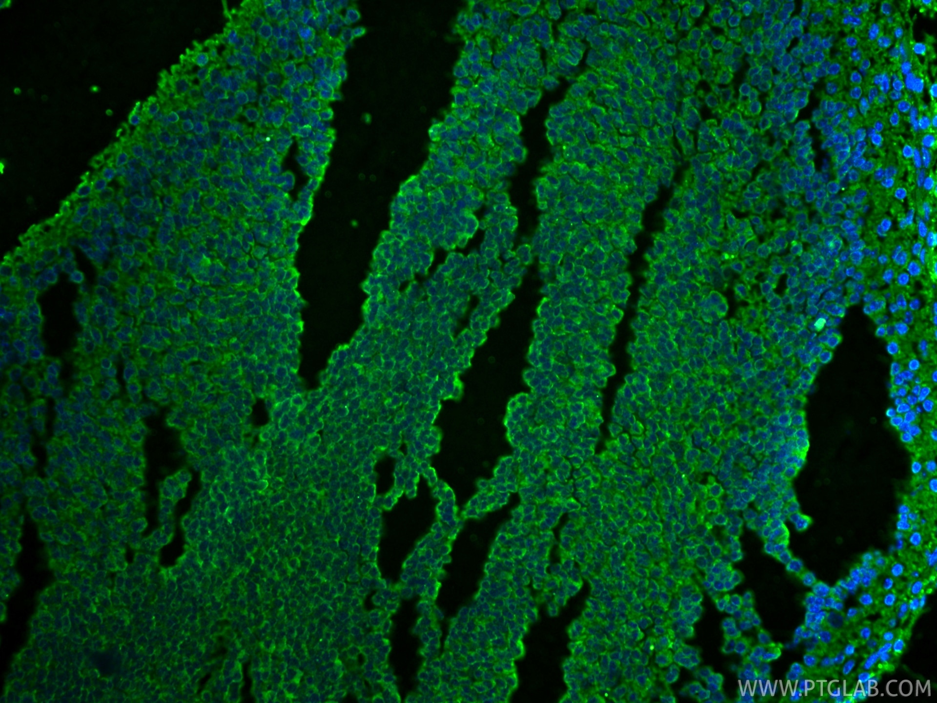Immunofluorescence (IF) / fluorescent staining of mouse embryo tissue using Cleaved Caspase 3/P17/P19 Monoclonal antibody (68773-1-Ig)