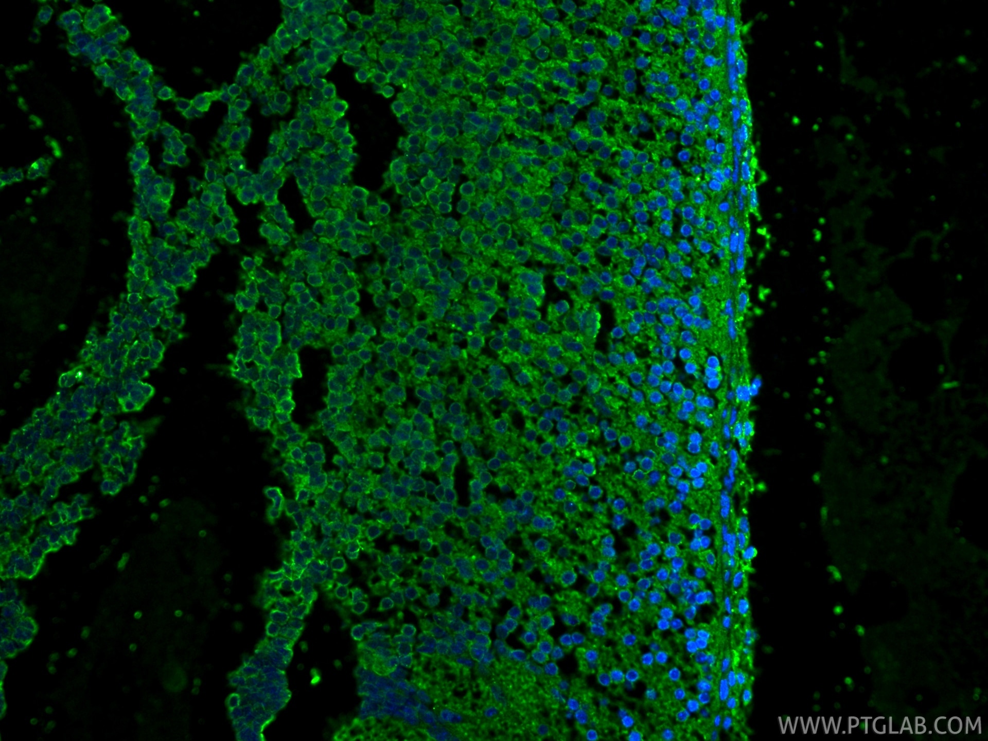 Immunofluorescence (IF) / fluorescent staining of mouse embryo tissue using Cleaved Caspase 3/P17/P19 Monoclonal antibody (68773-1-Ig)