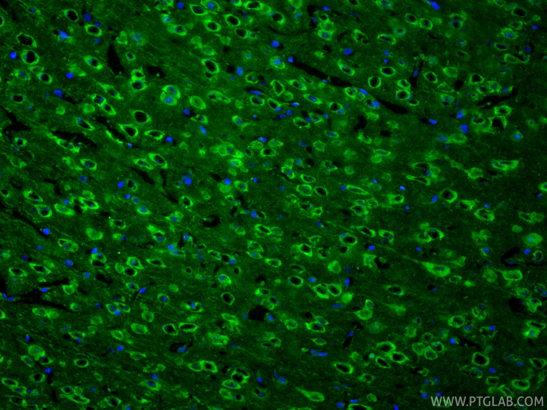 Immunofluorescence (IF) / fluorescent staining of mouse brain tissue using Cleaved Caspase 3/P17/P19 Monoclonal antibody (68773-1-Ig)