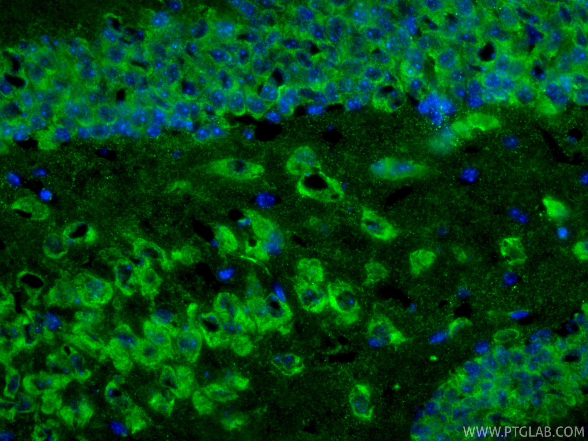 Immunofluorescence (IF) / fluorescent staining of mouse brain tissue using Cleaved Caspase 3/P17/P19 Monoclonal antibody (68773-1-Ig)