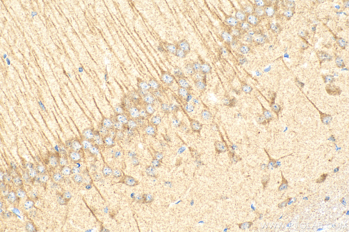Immunohistochemistry (IHC) staining of mouse brain tissue using Multi-rAb™ Cleaved Caspase 3/P17/P19 Multi-Recombi (RMX00003)
