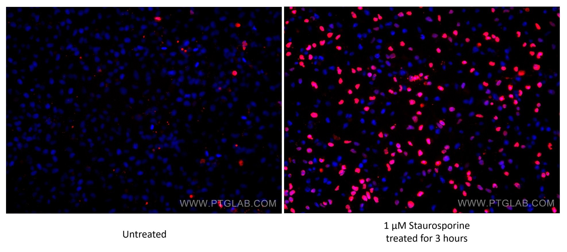 Immunofluorescence (IF) / fluorescent staining of HeLa cells using Cleaved PARP1 Monoclonal antibody (60555-1-Ig)