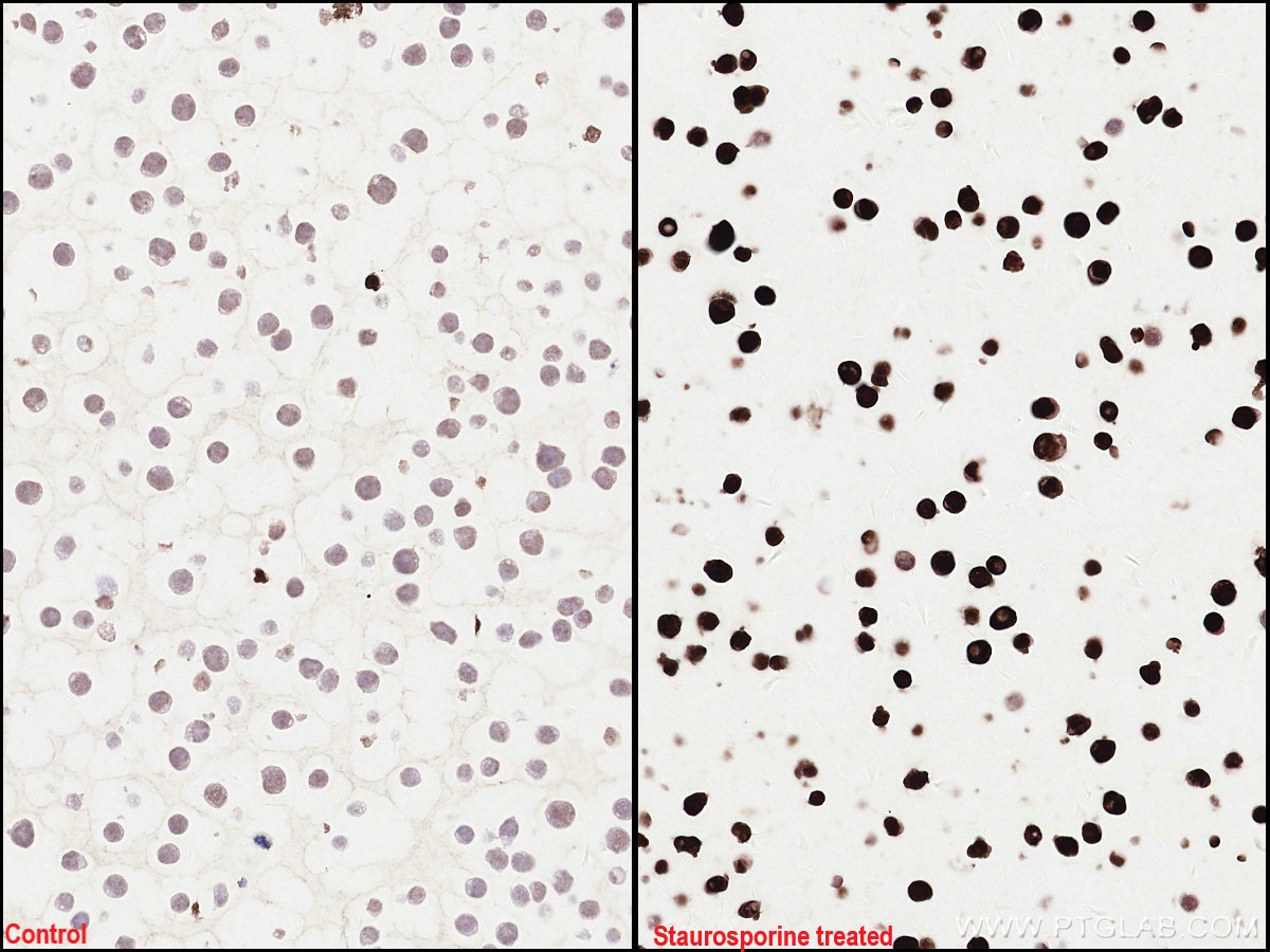 Immunohistochemistry (IHC) staining of Jurkat cells using Cleaved PARP1 Monoclonal antibody (60555-1-Ig)