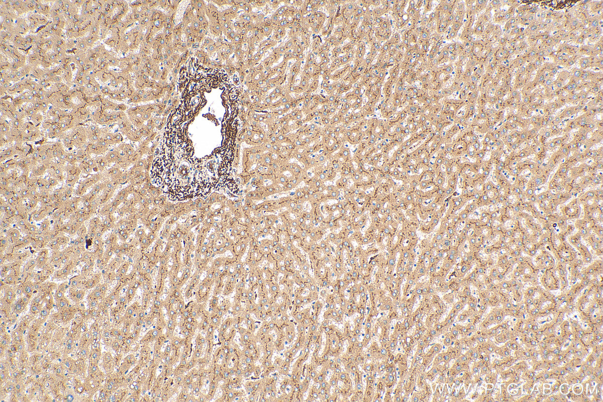 Immunohistochemistry (IHC) staining of human liver tissue using Clusterin Polyclonal antibody (30339-1-AP)