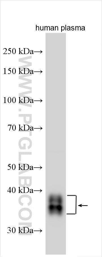 Western Blot (WB) analysis of various lysates using Clusterin Polyclonal antibody (30339-1-AP)