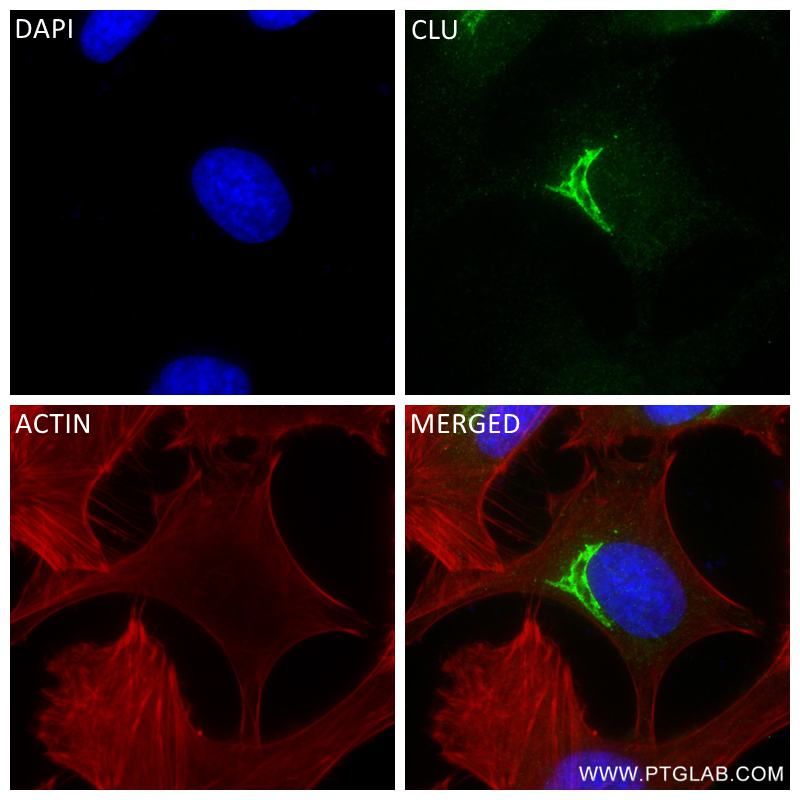 Immunofluorescence (IF) / fluorescent staining of HeLa cells using Clusterin Recombinant antibody (84067-4-RR)