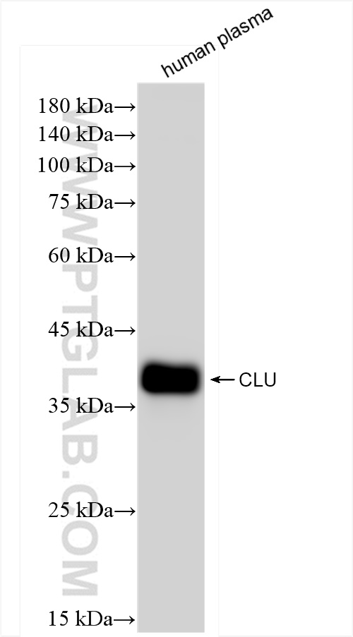 Western Blot (WB) analysis of human plasma using Clusterin Recombinant antibody (84067-4-RR)