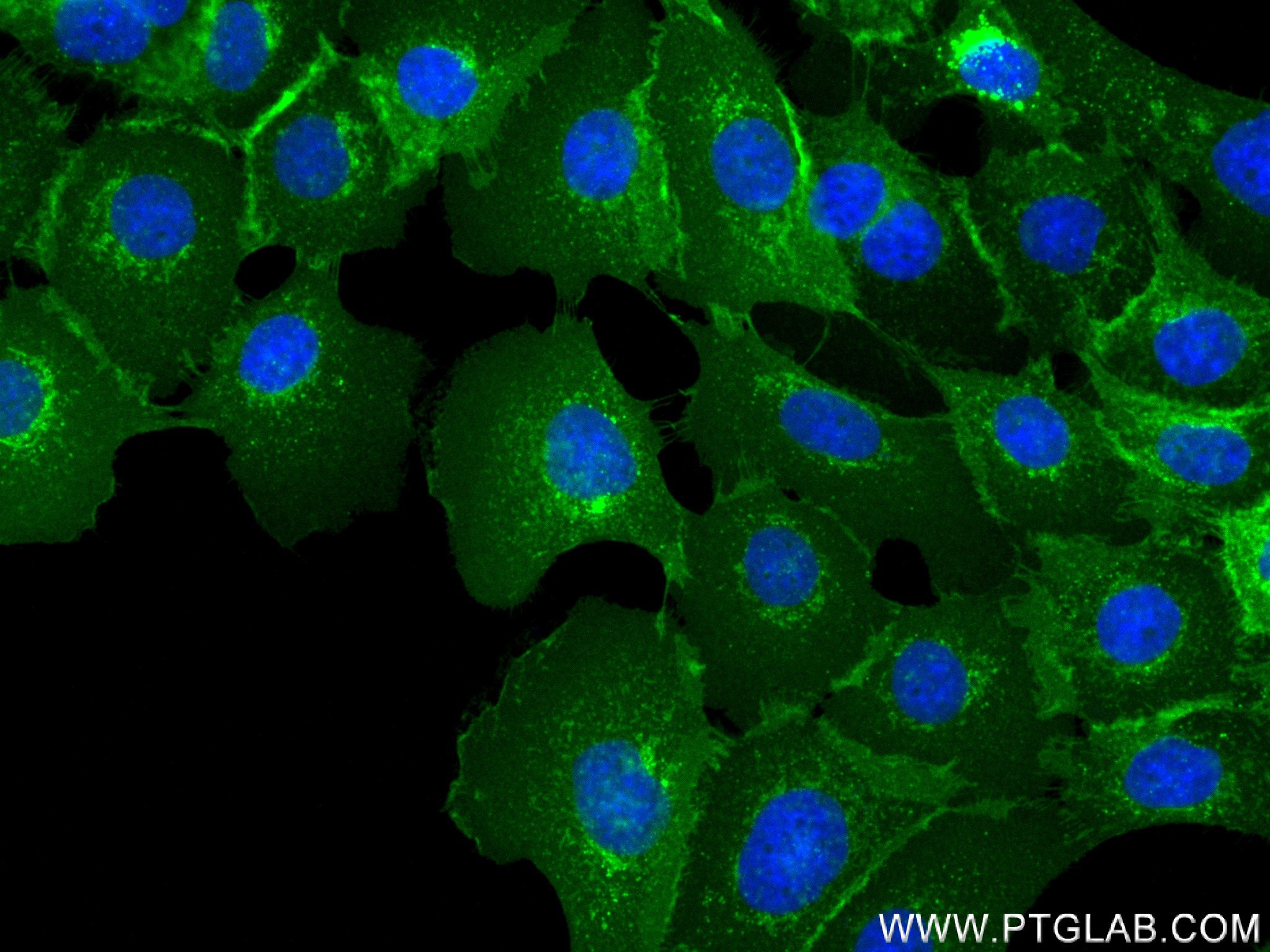 Immunofluorescence (IF) / fluorescent staining of A431 cells using Tissue Factor Recombinant antibody (83776-4-RR)