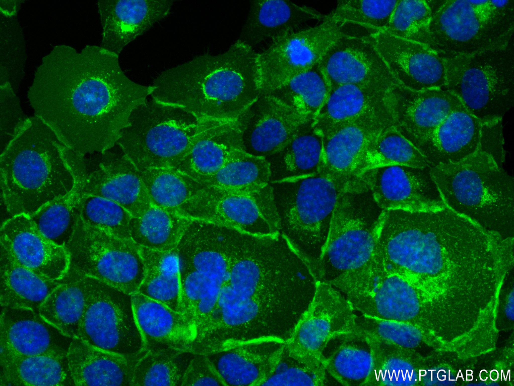 Immunofluorescence (IF) / fluorescent staining of A431 cells using Tissue Factor Recombinant antibody (83776-4-RR)