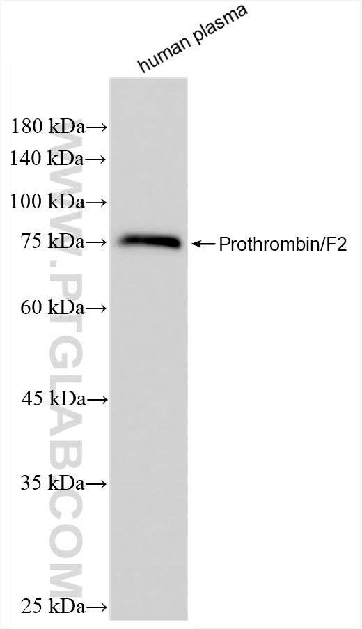 Western Blot (WB) analysis of human plasma using Coagulation factor II Recombinant antibody (86124-1-RR)