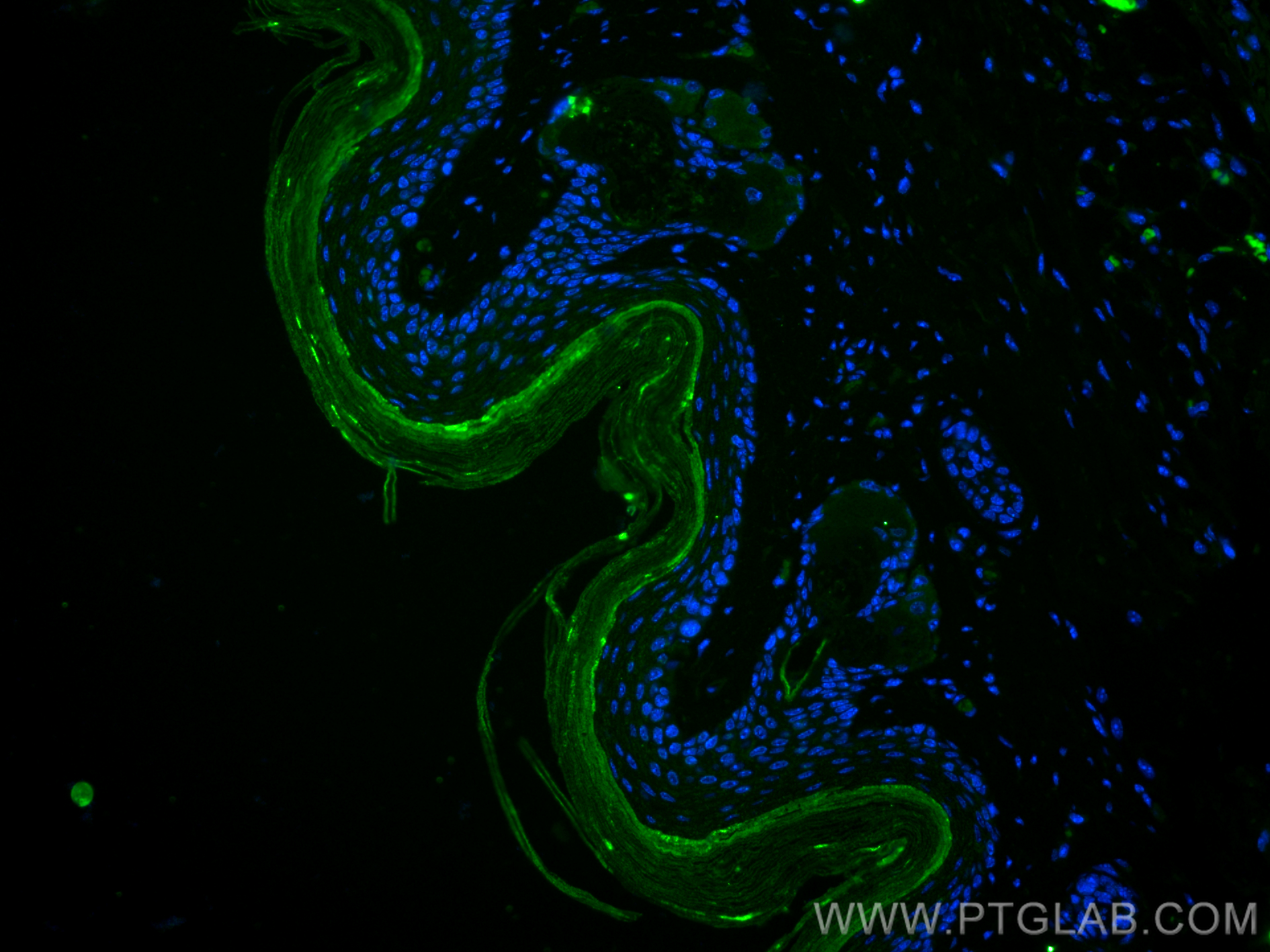 Immunofluorescence (IF) / fluorescent staining of mouse skin tissue using CoraLite® Plus 488-conjugated Collagen Type I Mono (CL488-67288)