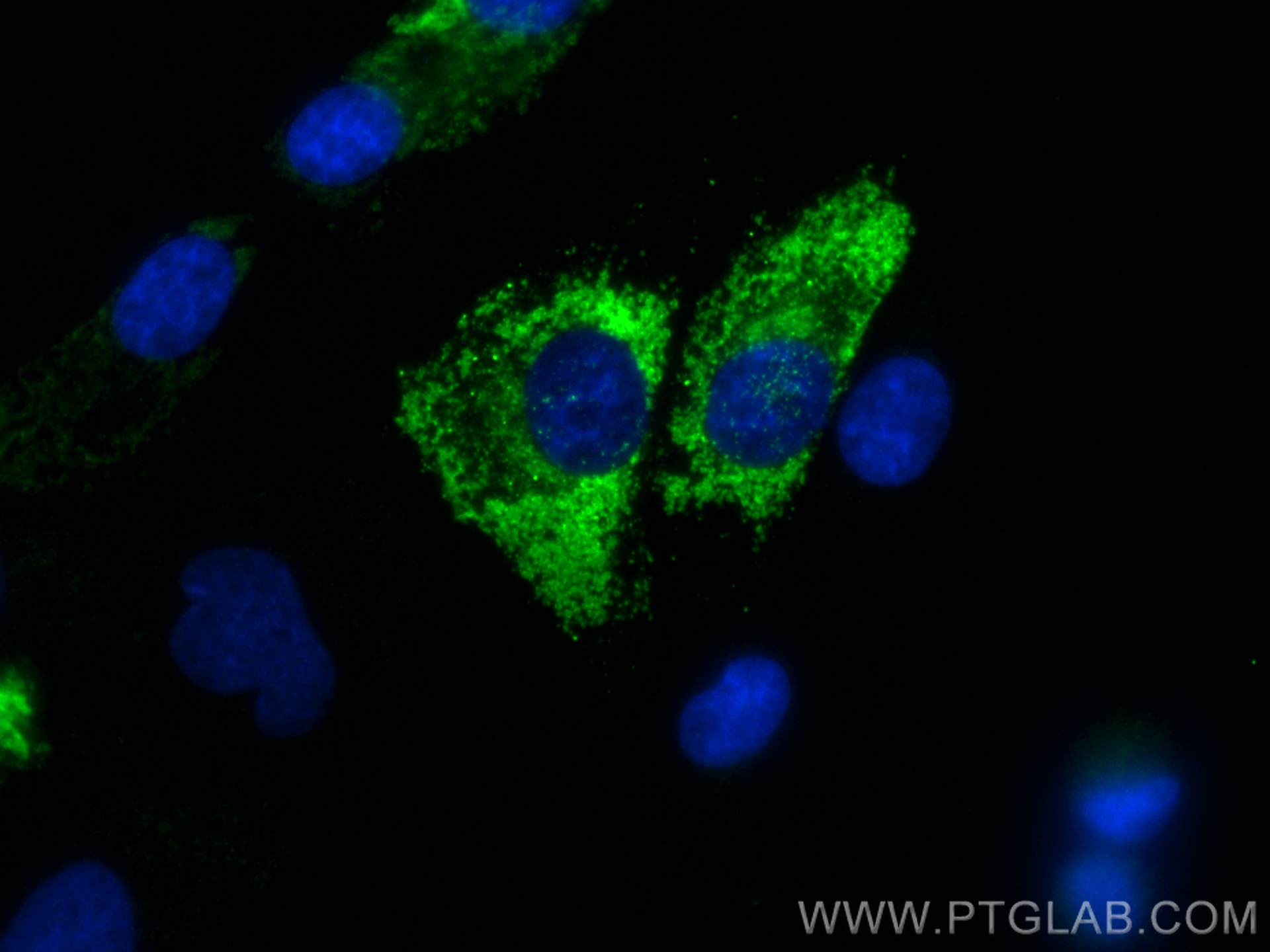 Immunofluorescence (IF) / fluorescent staining of HSC-T6 cells using CoraLite® Plus 488-conjugated Collagen Type I Reco (CL488-83752-5)