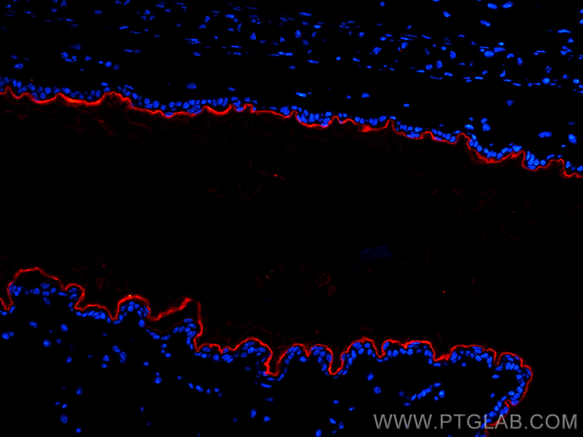 Immunofluorescence (IF) / fluorescent staining of mouse skin tissue using CoraLite®594-conjugated Collagen Type I Monoclonal (CL594-67288)