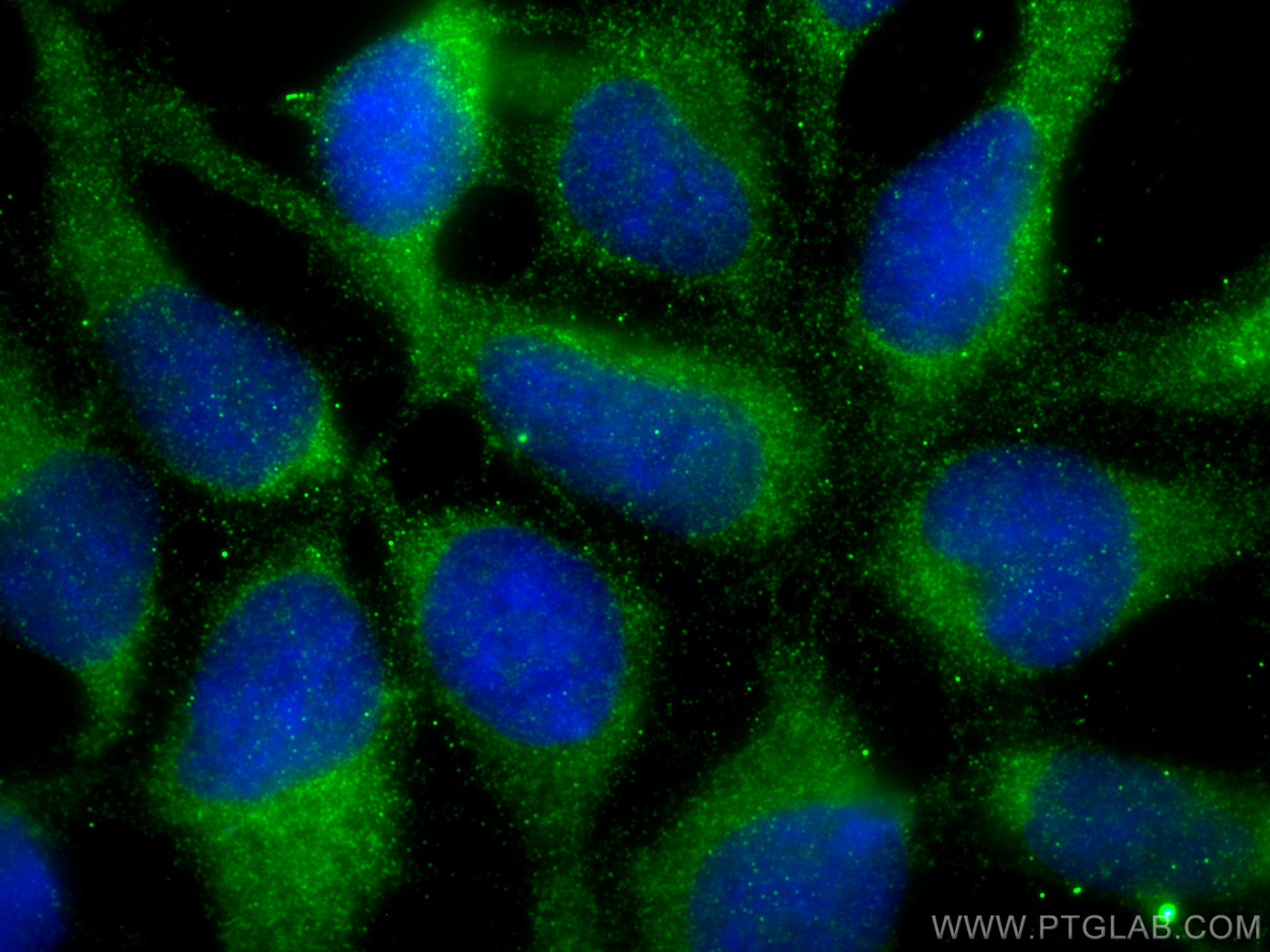 Immunofluorescence (IF) / fluorescent staining of HEK-293 cells using Collagen Type II Polyclonal antibody (28459-1-AP)