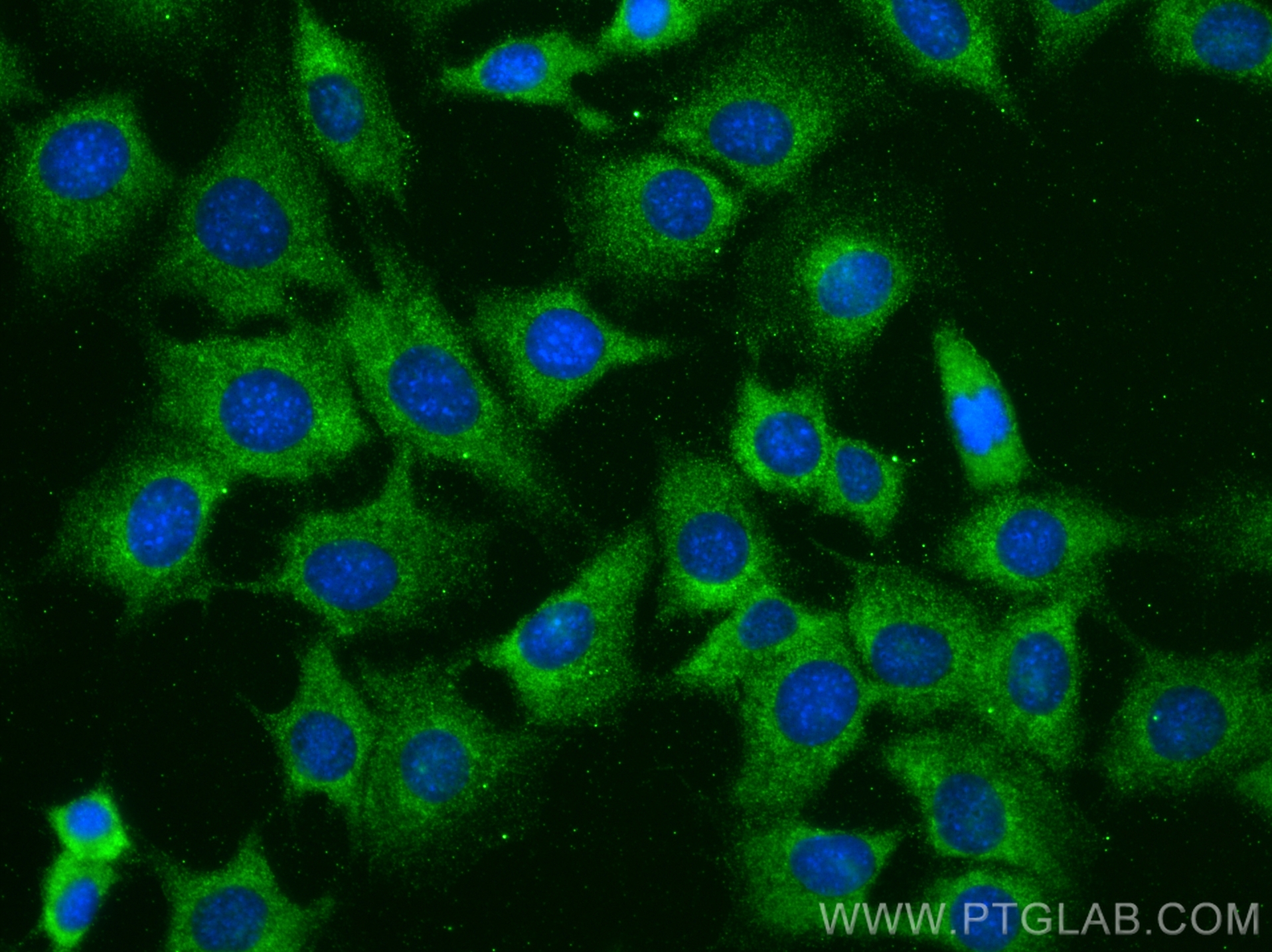 Immunofluorescence (IF) / fluorescent staining of ATDC-5 cells using Collagen Type II Polyclonal antibody (28459-1-AP)