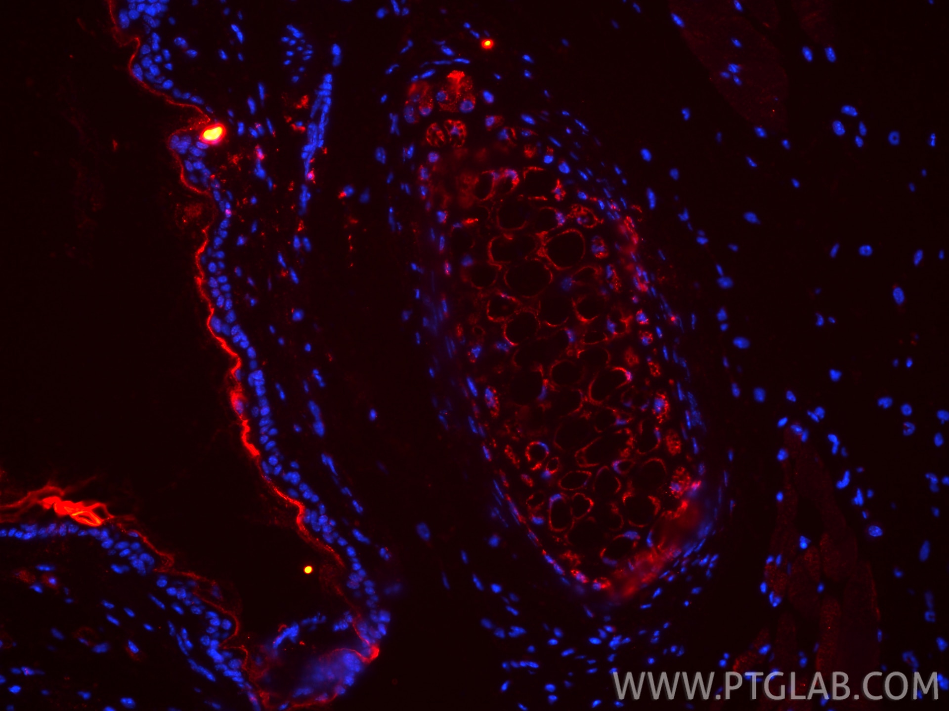 Immunofluorescence (IF) / fluorescent staining of mouse skin tissue using Collagen Type II Polyclonal antibody (28459-1-AP)