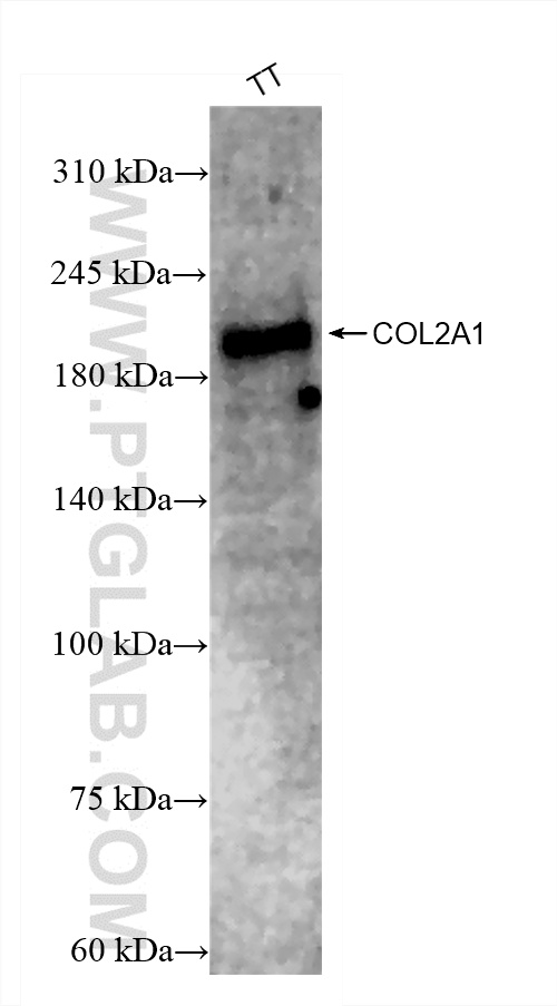 Western Blot (WB) analysis of TT cells using Collagen Type II Recombinant antibody (86139-2-RR)
