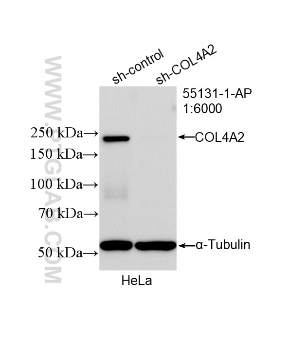 Western Blot (WB) analysis of HeLa cells using COL4A2 Polyclonal antibody (55131-1-AP)
