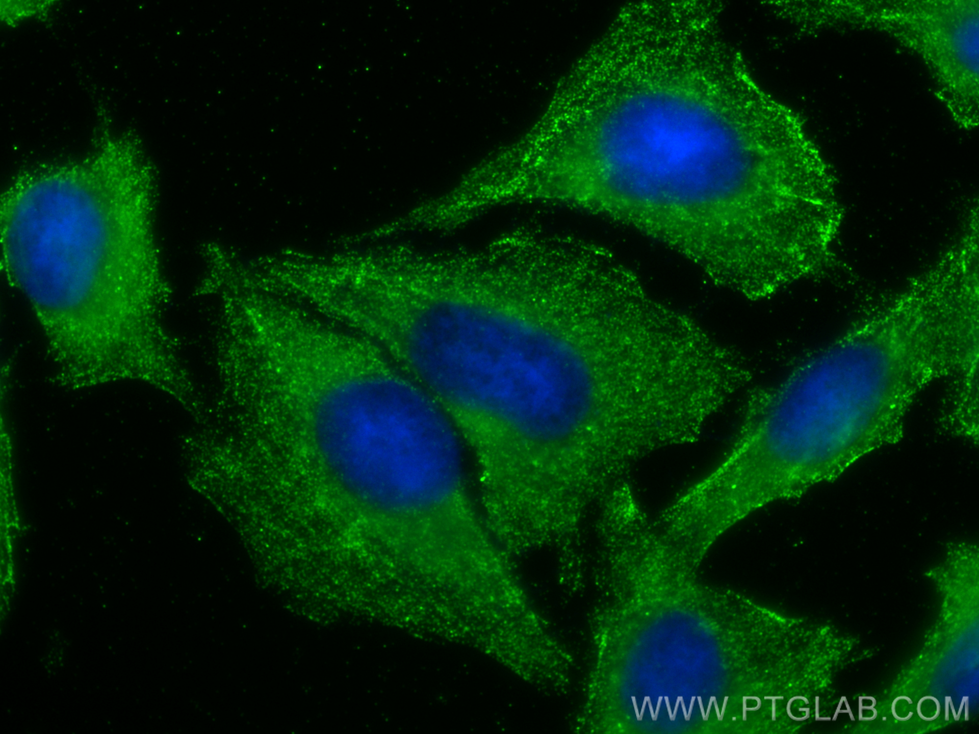 Immunofluorescence (IF) / fluorescent staining of U2OS cells using Collagen Type V Monoclonal antibody (67604-1-Ig)