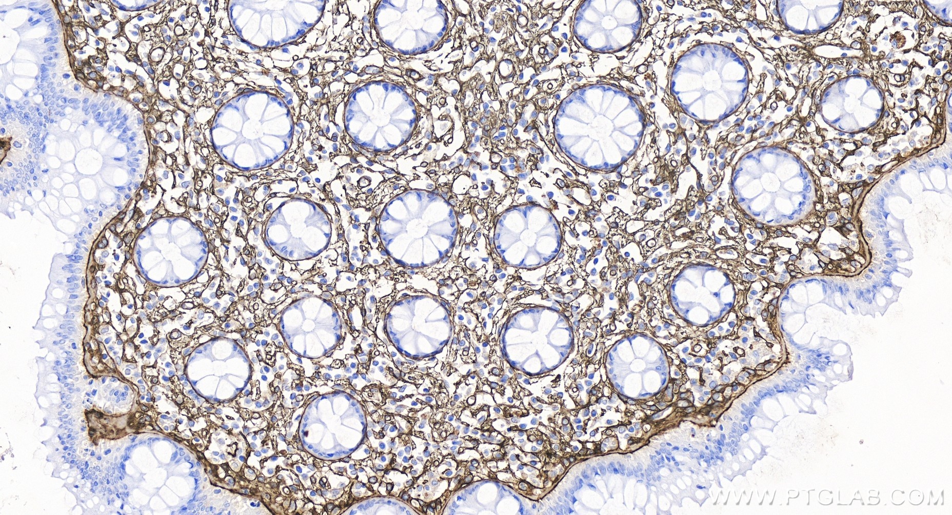 Immunohistochemistry (IHC) staining of human colon tissue using COL6A1 Recombinant antibody (85704-1-RR)