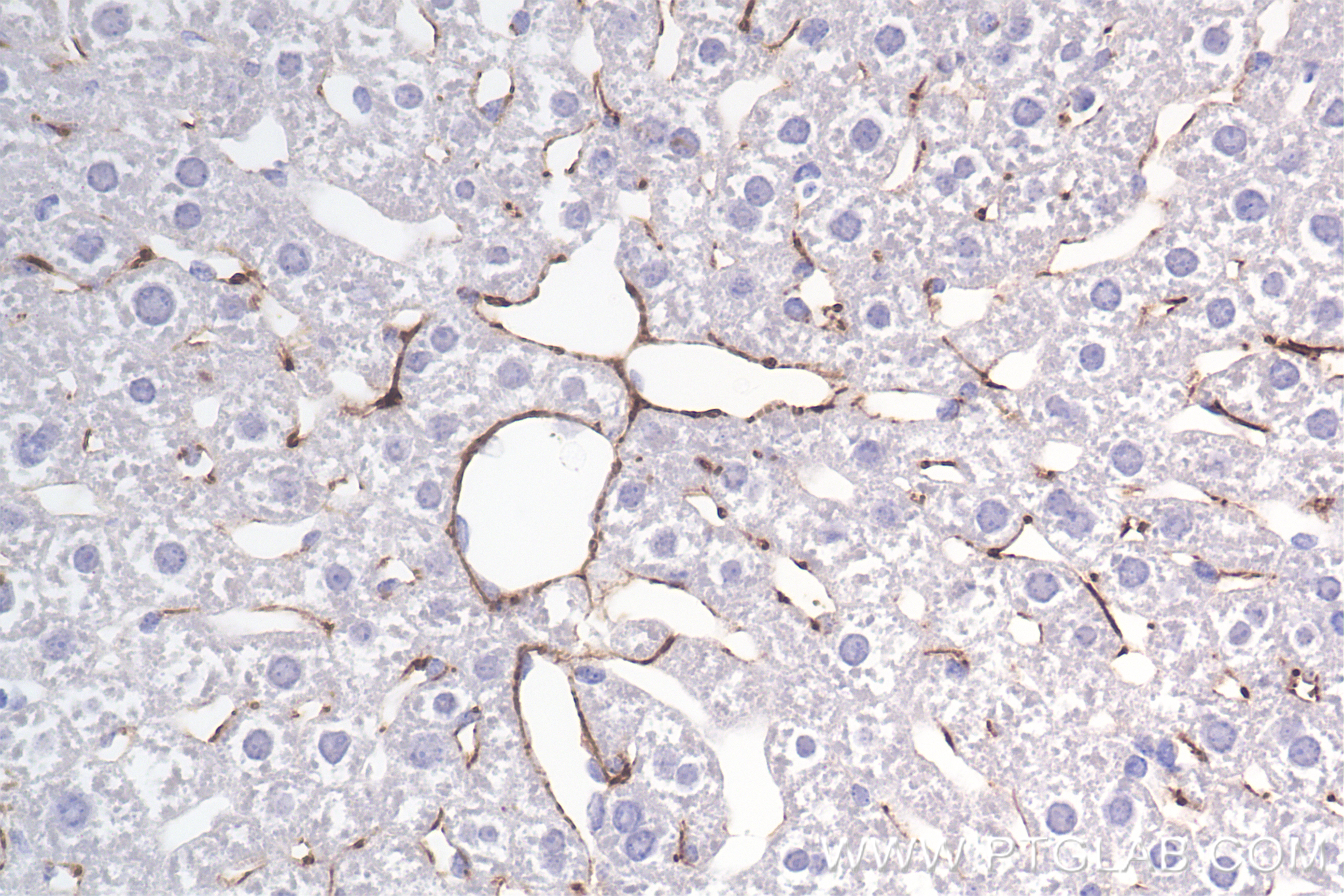 Immunohistochemistry (IHC) staining of mouse liver tissue using COL6A1 Recombinant antibody (85704-1-RR)