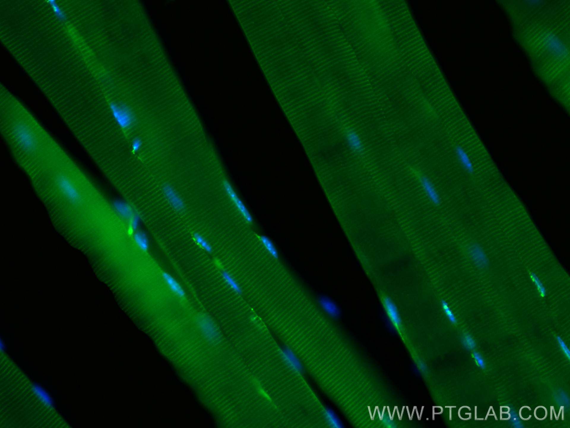 Immunofluorescence (IF) / fluorescent staining of mouse skeletal muscle tissue using CoraLite® Plus 488-conjugated Collagen Type VI Pol (CL488-17023)