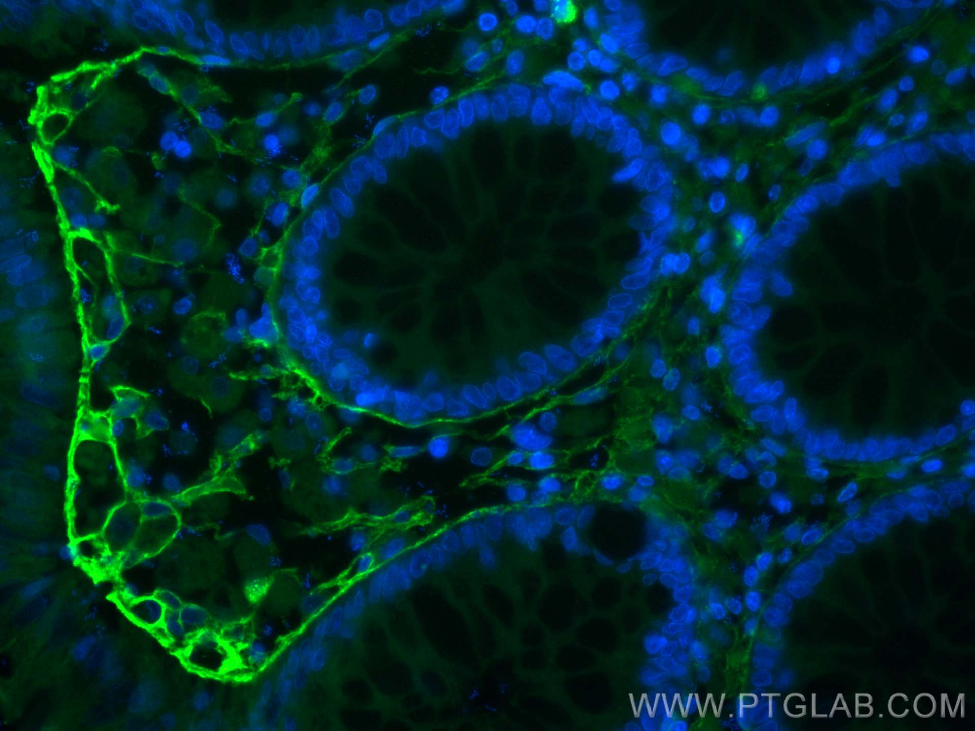 Immunofluorescence (IF) / fluorescent staining of human colon tissue using CoraLite® Plus 488-conjugated Collagen Type VI Pol (CL488-17023)