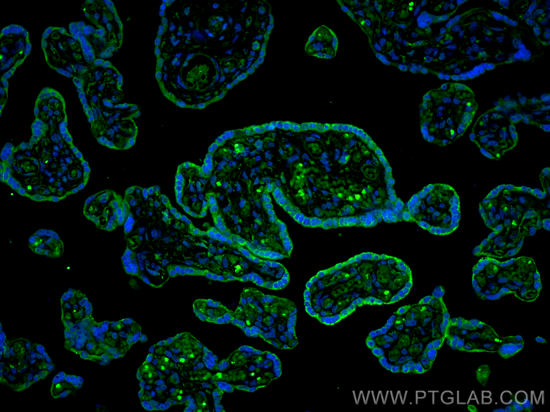 Immunofluorescence (IF) / fluorescent staining of human placenta tissue using Collagen Type XI Polyclonal antibody (21841-1-AP)