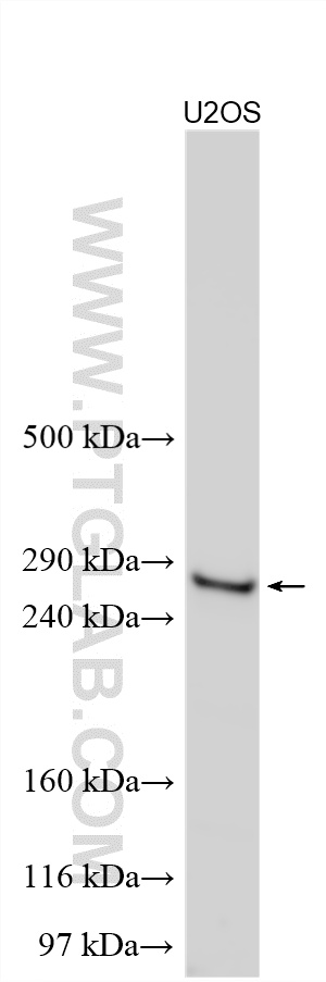 Western Blot (WB) analysis of various lysates using Collagen Type XI Polyclonal antibody (21841-1-AP)