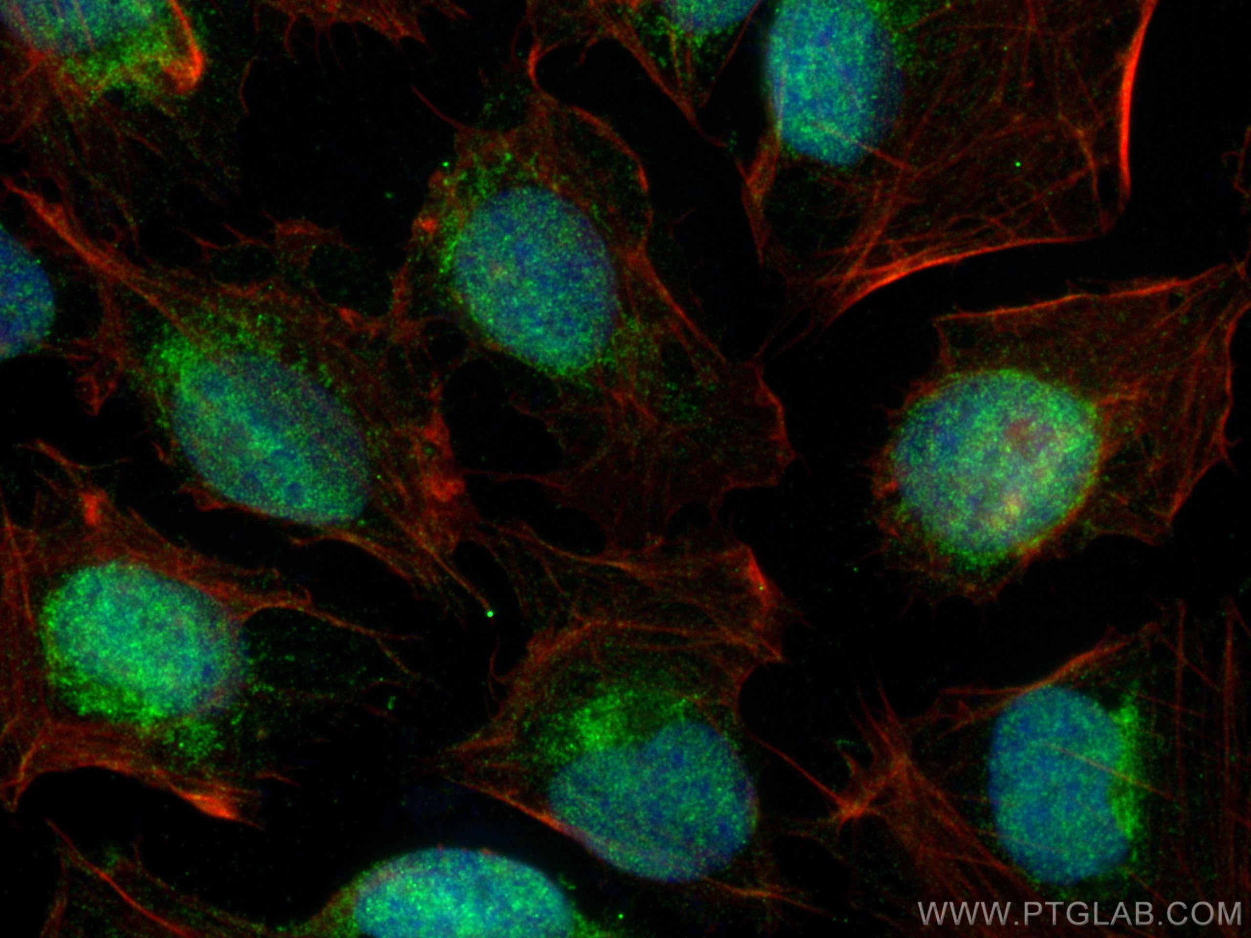 Immunofluorescence (IF) / fluorescent staining of U2OS cells using Collagen Type XXVIII Polyclonal antibody (24401-1-AP)