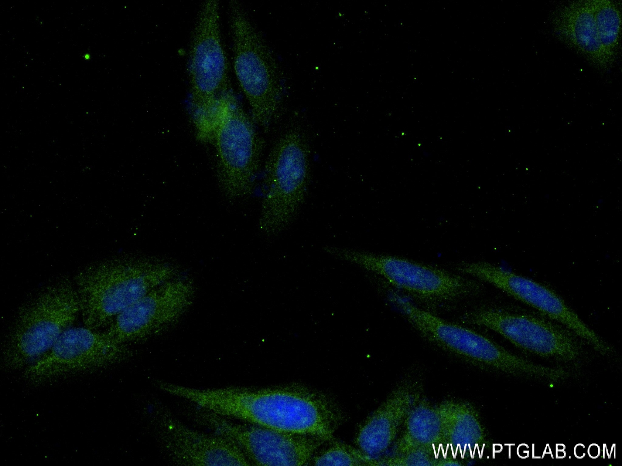 Immunofluorescence (IF) / fluorescent staining of HepG2 cells using Complement factor B Recombinant antibody (84101-5-RR)