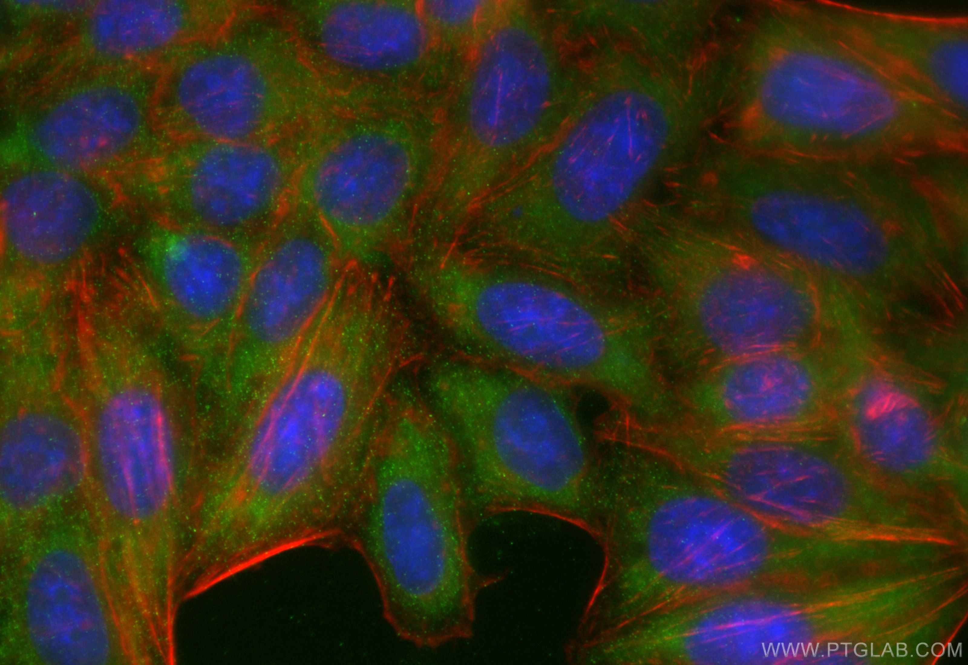 Immunofluorescence (IF) / fluorescent staining of HepG2 cells using Complement factor B Recombinant antibody (84101-5-RR)