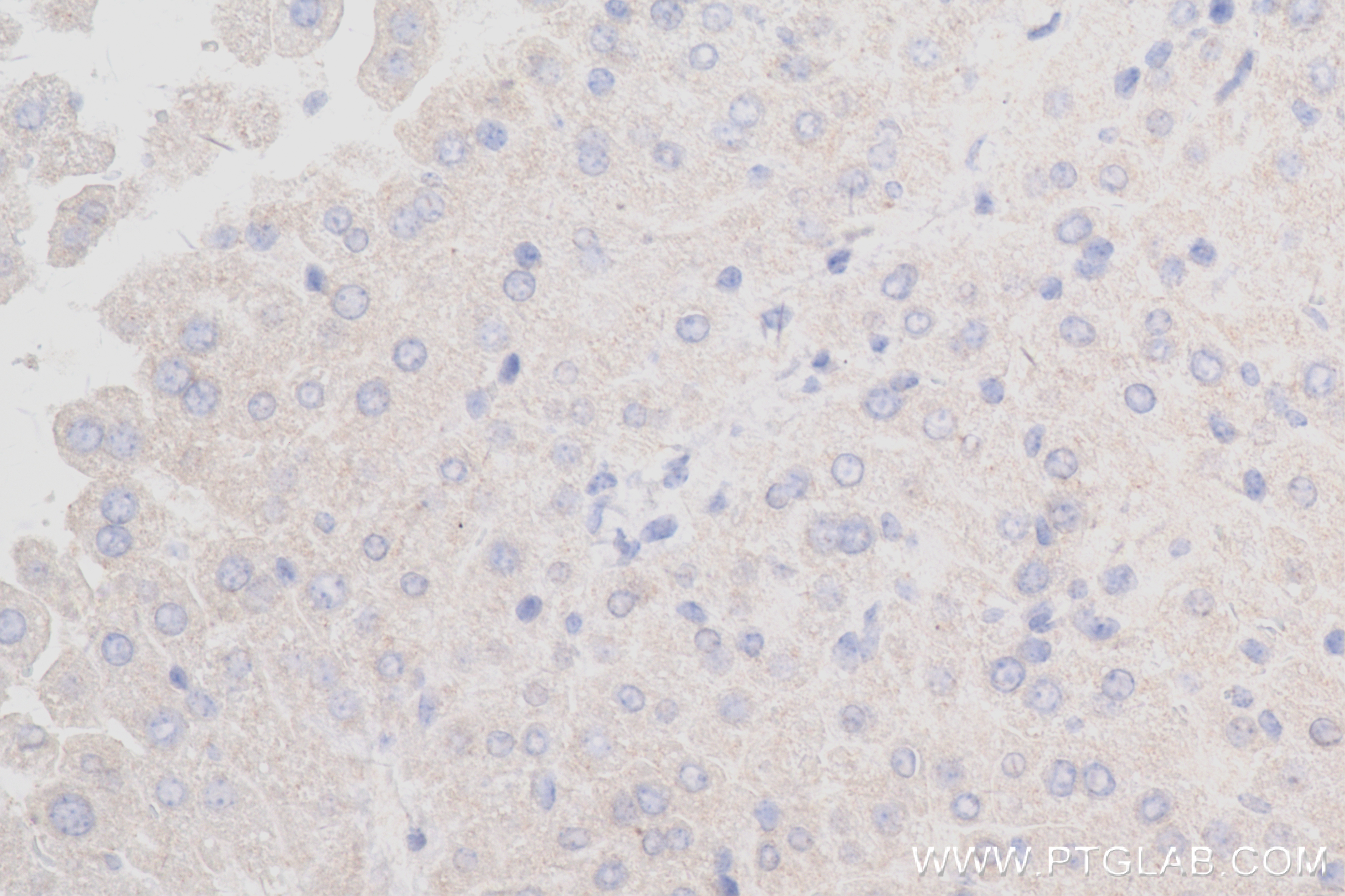 Immunohistochemistry (IHC) staining of mouse liver tissue using Complement factor B Recombinant antibody (84101-5-RR)