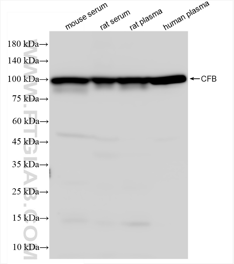 Western Blot (WB) analysis of various lysates using Complement factor B Recombinant antibody (84101-5-RR)