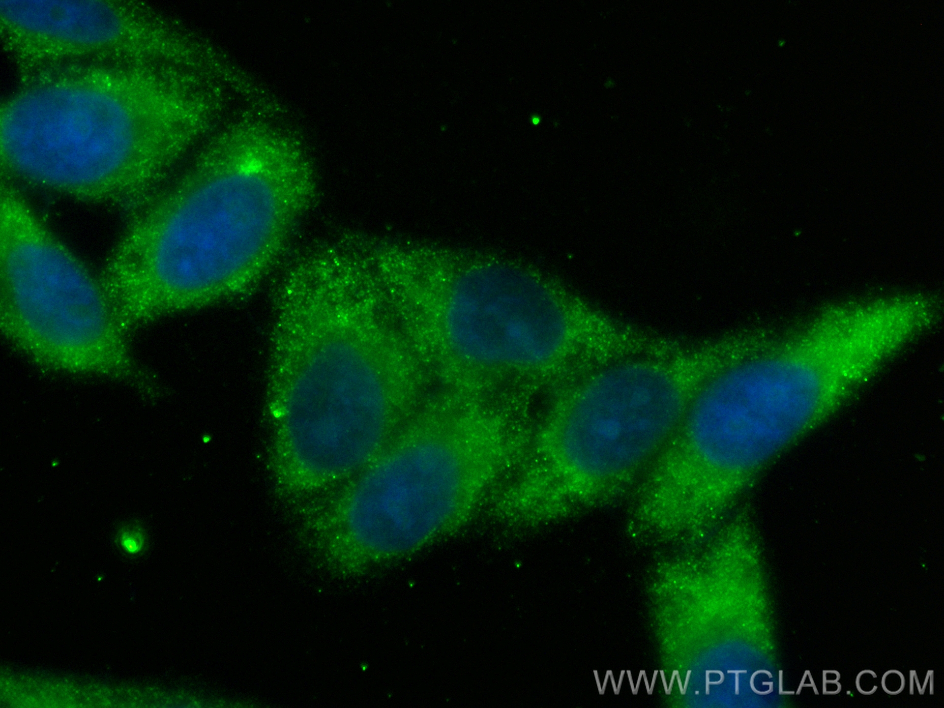 Immunofluorescence (IF) / fluorescent staining of HepG2 cells using CoraLite® Plus 488-conjugated Complement factor B  (CL488-84101-5)